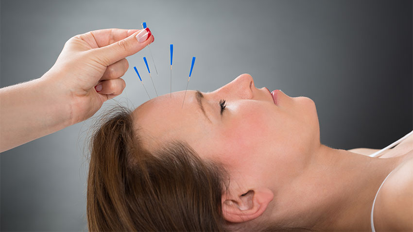 acupuncture-service